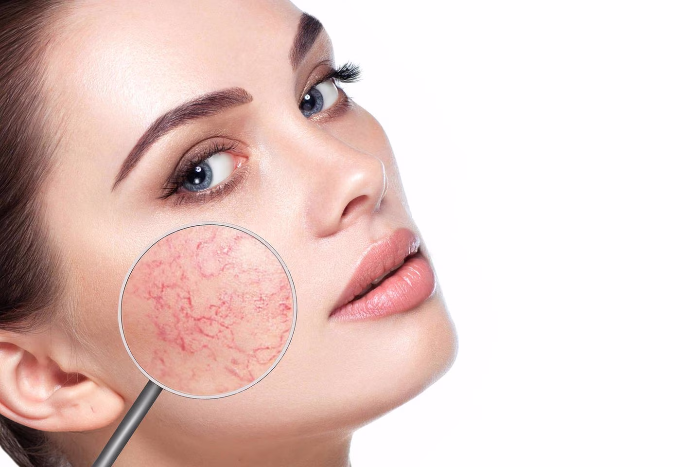 Şanlıurfa Leke Paketi